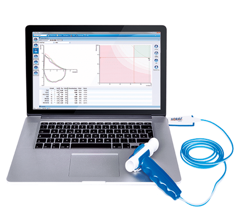 Spyrometer system